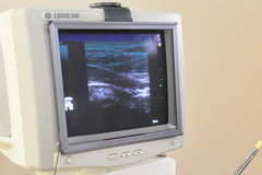 超音波画像観察装置（エコー）のイメージ